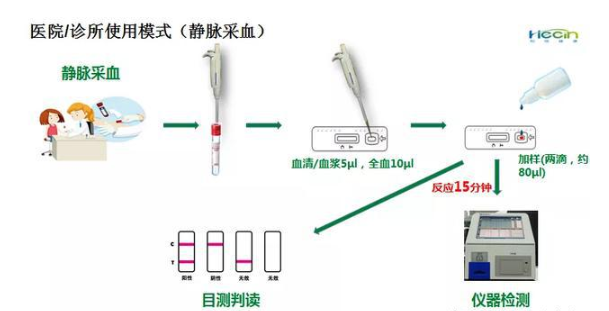 阿里全新AI诊断新冠肺炎技术：20 秒出结果，96% 准确率