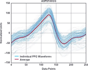  Individual PPG waveforms were extracted and plotted on top of each other